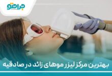 بهترین مرکز لیزر موهای زائد در صادقیه