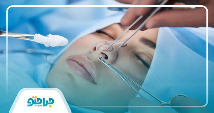 مراقبت‌های قبل و بعد از جراحی بینی گوشتی برای ماندگاری و فرم طبیعی بینی