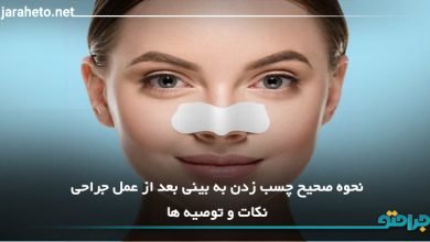 نحوه صحیح چسب زدن به بینی بعد از عمل جراحی