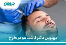 بهترین دکتر کاشت مو در کرج