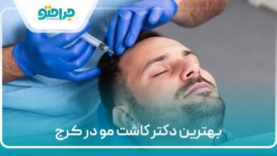بهترین دکتر کاشت مو در کرج