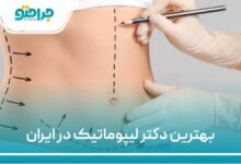 بهترین دکتر لیپوماتیک در ایران