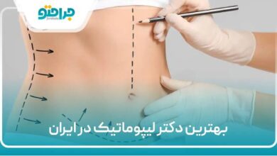 بهترین دکتر لیپوماتیک در ایران