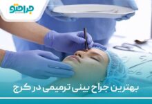 بهترین جراح بینی ترمیمی در کرج