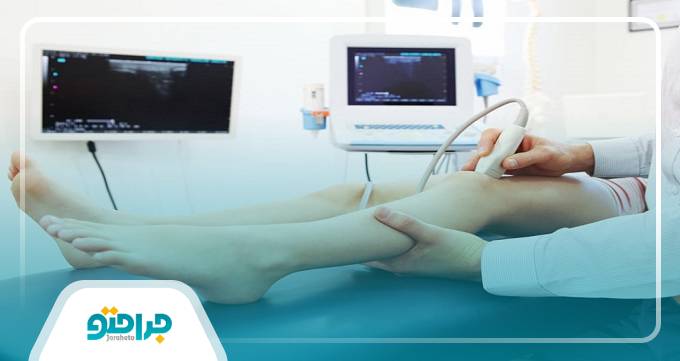 توصیههای بهترین متخصص واریس در تهران به بیماران و مراجعین