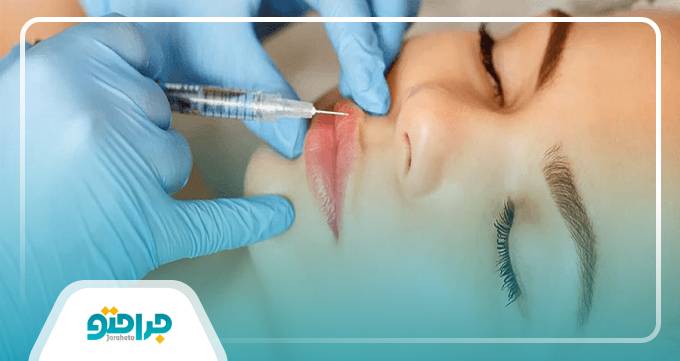 معایب تزریق چربی به صورت
