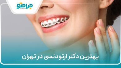 بهترین دکتر ارتودنسی در تهران
