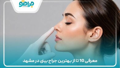 معرفی 10 تا از بهترین جراح بینی در مشهد
