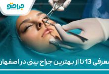 معرفی 13 تا از بهترین جراح بینی در اصفهان