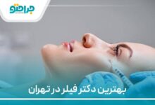 بهترین دکتر فیلر در تهران