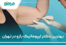 بهترین دکتر لیپوماتیک بازو در تهران