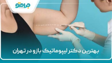بهترین دکتر لیپوماتیک بازو در تهران