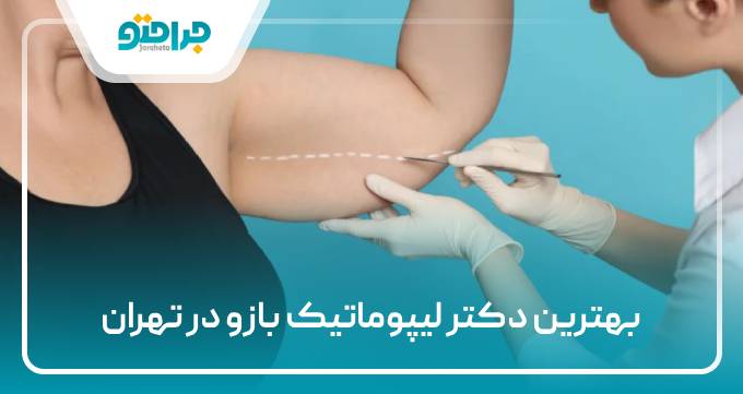 بهترین دکتر لیپوماتیک بازو در تهران