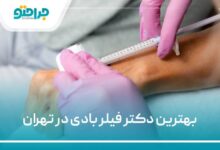 بهترین دکتر فیلر بادی در تهران