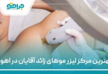 بهترین مرکز لیزر موهای زائد آقایان در اهواز