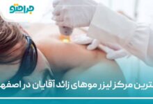 بهترین مرکز لیزر موهای زائد آقایان در اصفهان