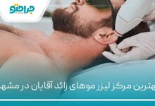 بهترین مرکز لیزر موهای زائد آقایان در مشهد