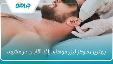بهترین مرکز لیزر موهای زائد آقایان در مشهد