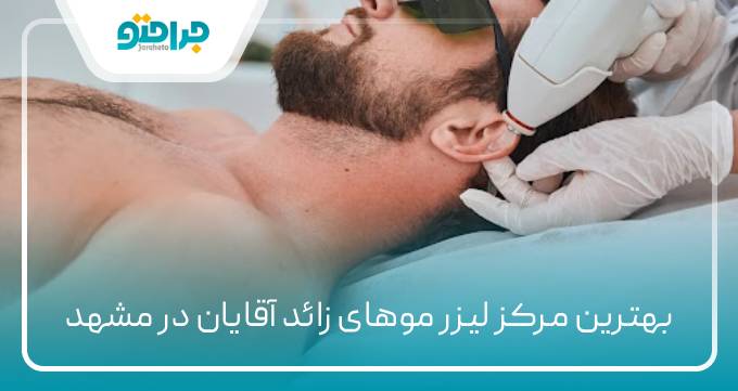 بهترین مرکز لیزر موهای زائد آقایان در مشهد