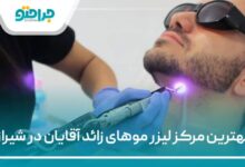بهترین مرکز لیزر موهای زائد آقایان در شیراز