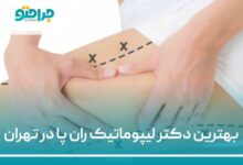 بهترین دکتر لیپوماتیک ران پا در تهران