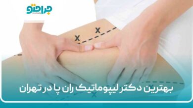 بهترین دکتر لیپوماتیک ران پا در تهران