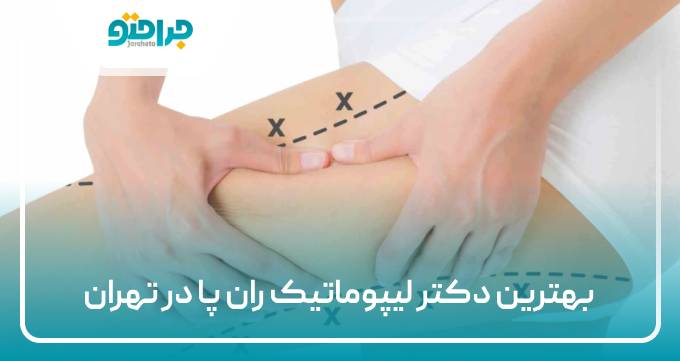 بهترین دکتر لیپوماتیک ران پا در تهران