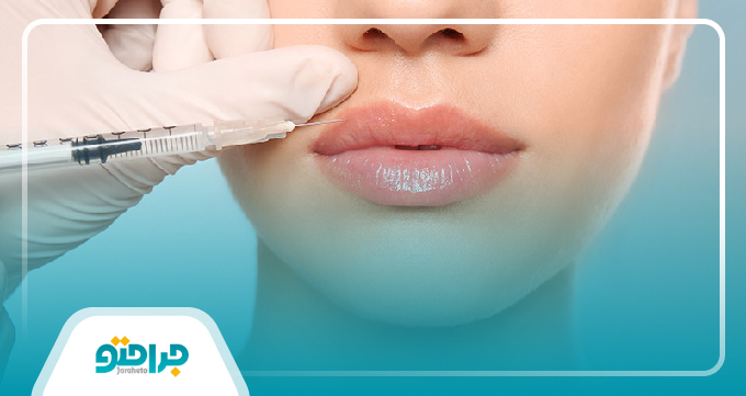 مدت ماندگاری تزریق ژل چقدر است؟