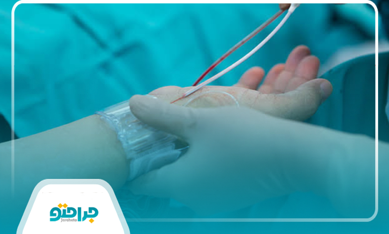 آنژیوگرافی از دست بهتر است یا پا؟