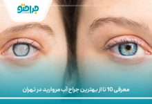 معرفی 10 تا از بهترین جراح آب مروارید در تهران