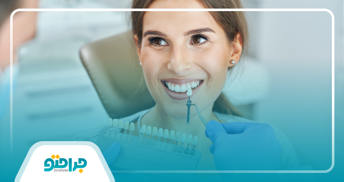 ویژگیهای بهترین متخصص لمینت در شهریار