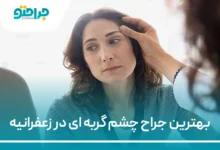 بهترین جراح چشم گربه ای در زعفرانیه