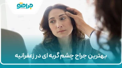 بهترین جراح چشم گربه ای در زعفرانیه