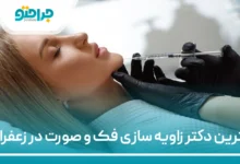 بهترین دکتر زاویه سازی فک و صورت در زعفرانیه