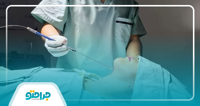 راهنمای تخصصی انتخاب بهترین جراح ساکشن غبغب در جنوب تهران