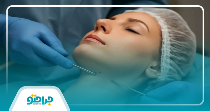 چه افرادی کاندید مناسب ساکشن غبغب هستند؟