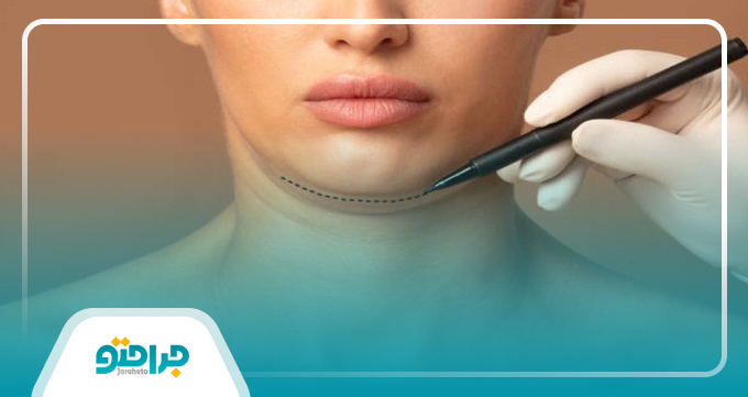 چرا مشاوره قبل از ساکشن غبغب اهمیت زیادی دارد؟