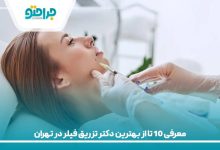 معرفی 10 تا از بهترین دکتر تزریق فیلر در تهران