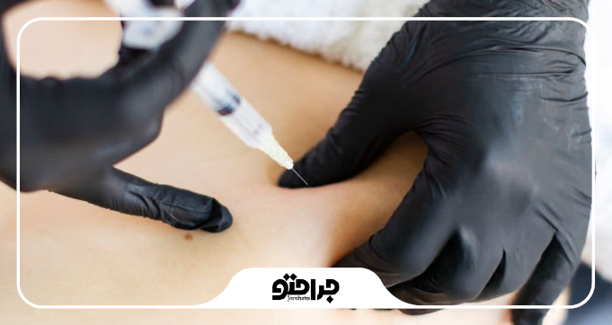 کدام نواحی بدن با فیلر بادی قابل اصلاح هستند؟
