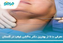 بهترین دکتر ساکشن غبغب در گلستان