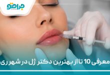 بهترین دکتر ژل در شهر ری