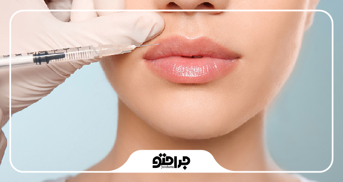 محبوب‌ترین نواحی تزریق ژل در شهر ری