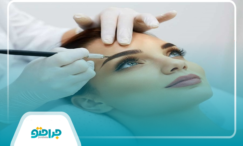 میکروبلیدینگ چیست و چگونه انجام میشود؟