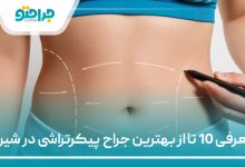 معرفی 10 تا از بهترین جراح پیکرتراشی در شیراز