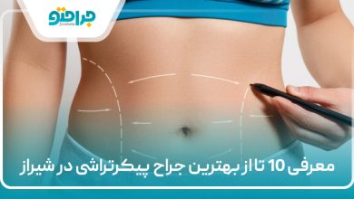 معرفی 10 تا از بهترین جراح پیکرتراشی در شیراز