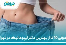 معرفی 10 تا از بهترین دکتر لیپوماتیک در تهران