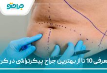 معرفی 10 تا از بهترین جراح پیکرتراشی در کرج