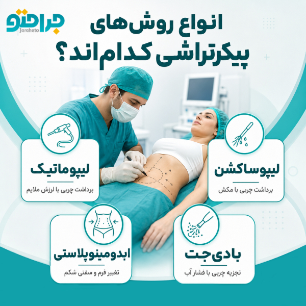 انواع روش‌های پیکرتراشی کدام‌اند؟