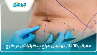 معرفی 10 تا از بهترین جراح پیکرتراشی در کرج