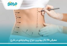 معرفی 10 تا از بهترین جراح پیکرتراشی در کرج
